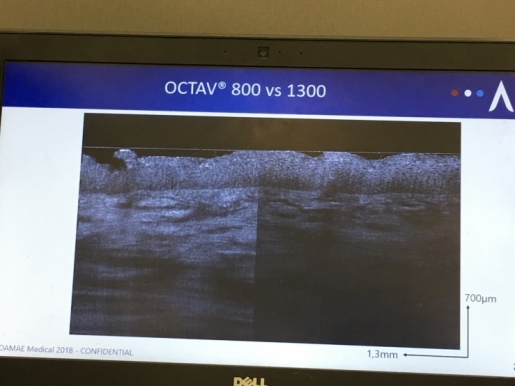 Damae medicalのLC-OCT(Line-Field Confocal OCT)