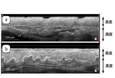 手の甲のLC-OCT断層イメージ