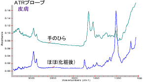 測定例